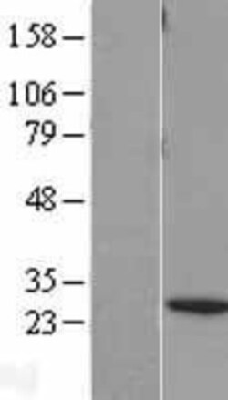 Novus Biologicals&trade;&nbsp;BNIP1 Overexpression Lysate