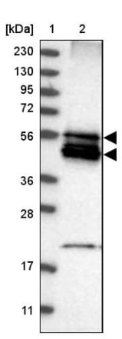 BNIP2 Antibody, Novus Biologicals 25 &mu;L | Buy Online | Novus Biologicals | Fisher Scientific
