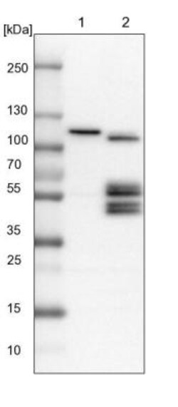 BNIP2 Antibody, Novus Biologicals 25 &mu;L | Buy Online | Novus Biologicals | Fisher Scientific