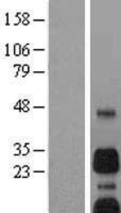 Novus Biologicals&trade;&nbsp;BNIP3 Overexpression Lysate