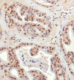 BNIP3L Antibody - BSA Free, Novus Biologicals:Antibodies:Primary Antibodies