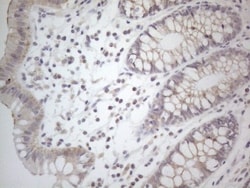 NT-proBNP Antibody (OTI11G4), Novus Biologicals 0.1mL; Unlabeled:Antibodies