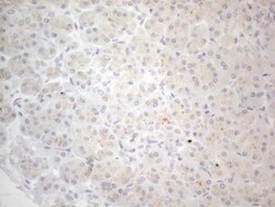NT-proBNP Antibody (OTI11G4), Novus Biologicals 0.1mL; Unlabeled:Antibodies
