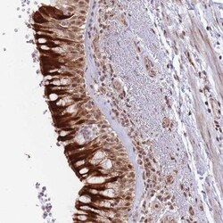 BOD1L Antibody, Novus Biologicals:Antibodies:Primary Antibodies
