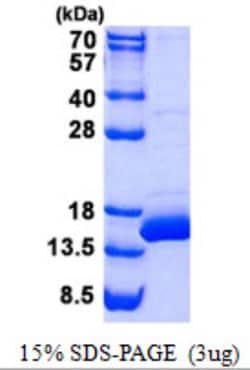 Novus Biologicals&trade;&nbsp;Recombinant Human BOLA1 His Protein