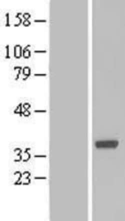Novus Biologicals&trade;&nbsp;Boll Overexpression Lysate