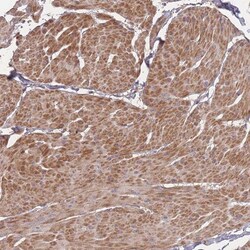 Bone marrow stromal cell antigen 1/CD157 Antibody, Novus Biologicals 0.1mL;