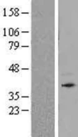 Novus Biologicals™ Bone marrow stromal cell antigen 1/CD157 Overexpression Lysate