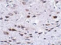 Bora Antibody - BSA Free, Novus Biologicals 0.1mg; Unlabeled:Antibodies,