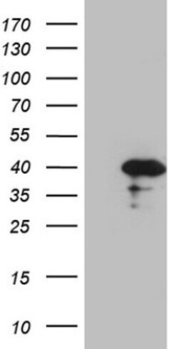 Borealin Antibody (OTI4G3), Novus Biologicals 0.1mL; Unlabeled:Antibodies,