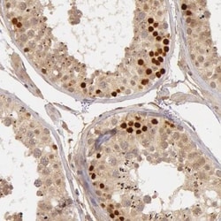 BORIS Antibody, Novus Biologicals 25 &mu;L | Buy Online | Novus Biologicals | Fisher Scientific