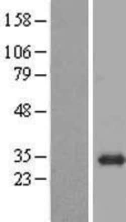 Novus Biologicals™ BPGM Overexpression Lysate