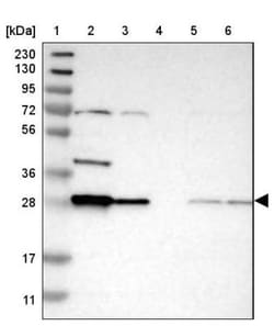 BPGM Antibody, Novus Biologicals:Antibodies:Primary Antibodies