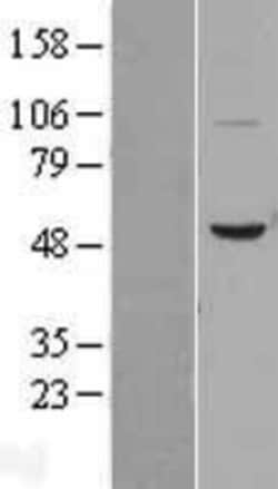 Novus Biologicals&trade;&nbsp;BPI Overexpression Lysate