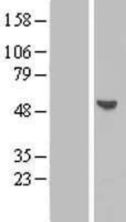Novus Biologicals™ BPIL1 Overexpression Lysate