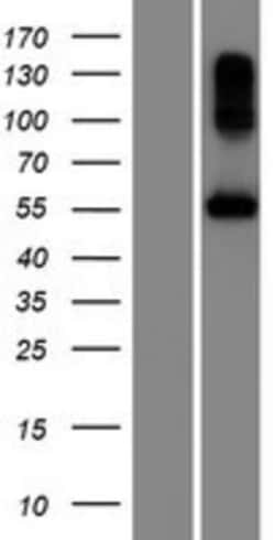 Novus Biologicals&trade;&nbsp;BPIL2 Overexpression Lysate