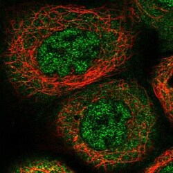 BPIL2 Antibody, Novus Biologicals 25 &mu;L; Unlabeled:Antibodies, Polyclonal