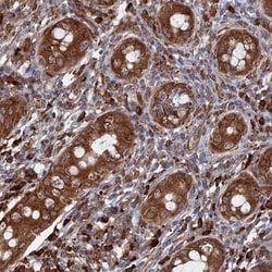 BPIL3 Antibody, Novus Biologicals 25 &mu;L | Buy Online | Novus Biologicals | Fisher Scientific