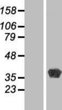 Novus Biologicals&trade;&nbsp;BPNT1 Overexpression Lysate
