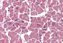 BPOZ Antibody, Novus Biologicals 0.1mg; Unlabeled:Antibodies, Polyclonal