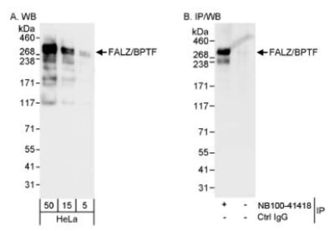 BPTF/FALZ Antibody 0.1mL; Unlabeled:Antibodies, Polyclonal | Fisher ...