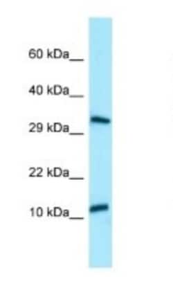 BPY2 Antibody, Novus Biologicals 100 &mu;L | Buy Online | Novus Biologicals | Fisher Scientific
