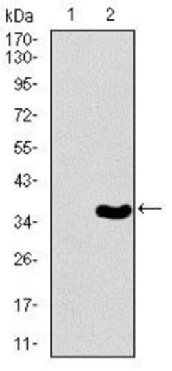 Brachyury Antibody (1H9A2) - BSA Free, Novus Biologicals 0.1mL; Unlabeled:Antibodies,