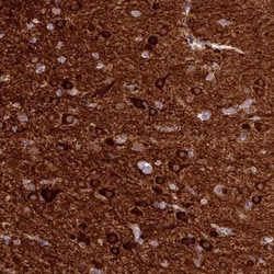Bradykinin RB2/BDKRB2 Antibody, Novus Biologicals 0.1mL; Unlabeled:Antibodies,
