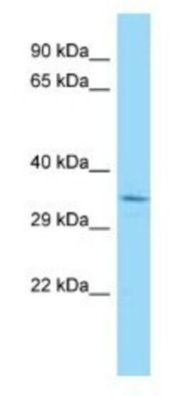 BRAF35 Antibody, Novus Biologicals:Antibodies:Primary Antibodies