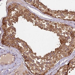 BRAP Antibody, Novus Biologicals 0.1mL; Unlabeled:Antibodies, Polyclonal