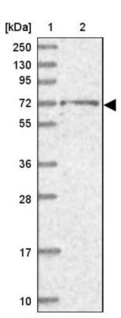 BRAP Antibody, Novus Biologicals 0.1mL; Unlabeled:Antibodies, Polyclonal