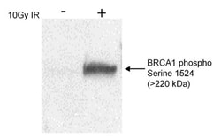 BRCA1, p Ser1524 Antibody, Novus Biologicals 0.1mg; Unlabeled:Antikörper