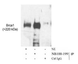 BRCA1 Antibody, Novus Biologicals 0.1mg; Unlabeled:Antibodies, Polyclonal