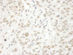 BRCAA1 Antibody, Novus Biologicals 0.1mg; Unlabeled:Antibodies, Polyclonal