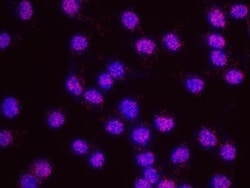 BRCAA1 Antibody, Novus Biologicals 0.1mg; Unlabeled:Antibodies, Polyclonal