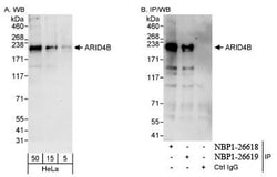 BRCAA1 Antibody, Novus Biologicals 0.1mg; Unlabeled:Antibodies, Polyclonal