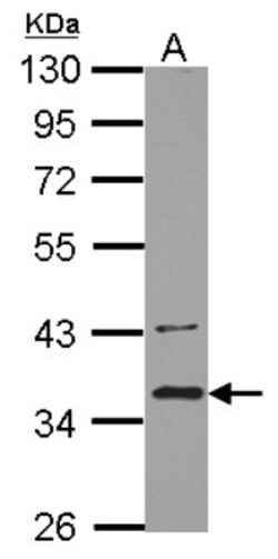 BRCC3 Antibody, Novus Biologicals 0.1 mL | Buy Online | Novus Biologicals | Fisher Scientific