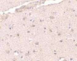 BRCC3 Antibody - BSA Free, Novus Biologicals 0.1mg; Unlabeled:Antibodies,