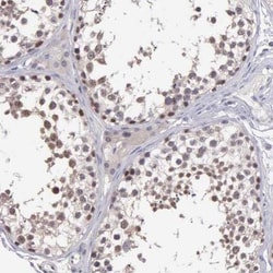 BRD1 Antibody, Novus Biologicals 25 &mu;L; Unlabeled:Antibodies, Polyclonal