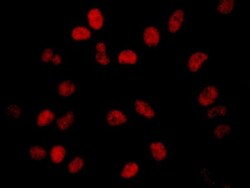 BRD2 Antibody, Novus Biologicals 0.1mL; Unlabeled:Antibodies, Polyclonal