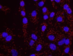 BRD4 Antibody, Novus Biologicals 0.1mL; Unlabeled:Antibodies, Polyclonal