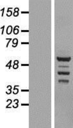 Novus Biologicals&trade;&nbsp;BRD9 Overexpression Lysate