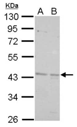 BRE Antibody, Novus Biologicals 100 &mu;L | Buy Online | Novus Biologicals | Fisher Scientific
