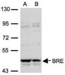 BRE Antibody, Novus Biologicals 100 &mu;L | Buy Online | Novus Biologicals | Fisher Scientific