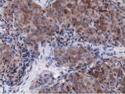 Breast cancer suppressor candidate 1 Antibody (OTI3D6), Novus Biologicals
