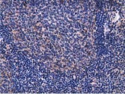 Breast cancer suppressor candidate 1 Antibody (OTI3D6), Novus Biologicals