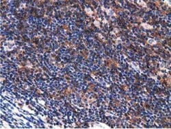 Breast cancer suppressor candidate 1 Antibody (OTI3D6), Novus Biologicals