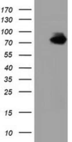 Breast cancer suppressor candidate 1 Antibody (OTI3D6), Novus Biologicals