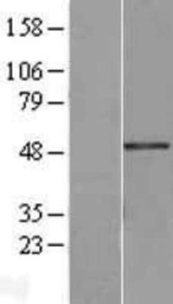 Novus Biologicals&trade;&nbsp;Breast cancer suppressor candidate 1 Overexpression Lysate