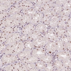 Breast carcinoma amplified sequence 3 Antibody, Novus Biologicals 0.1mL;